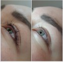 Lash volume lifting